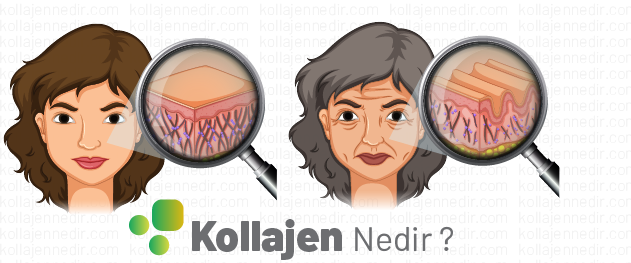 Hangi kollajen türü önemlidir ?
